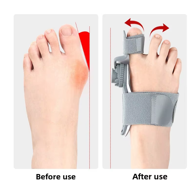 Foot Orthosis Adjustable Separator